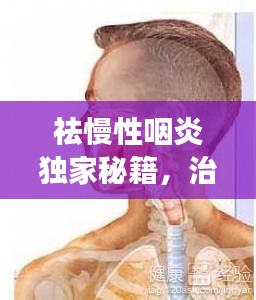 祛慢性咽炎独家秘籍，治疗慢性咽炎的特效 