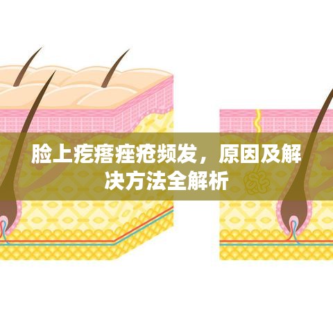 脸上疙瘩痤疮频发，原因及解决方法全解析