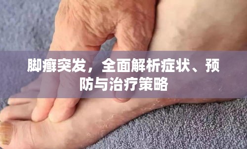 脚癣突发，全面解析症状、预防与治疗策略